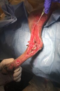 Leg wound from a hit-by-car canine patient.