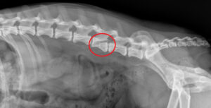 Pre-Operative Spinal Fracture