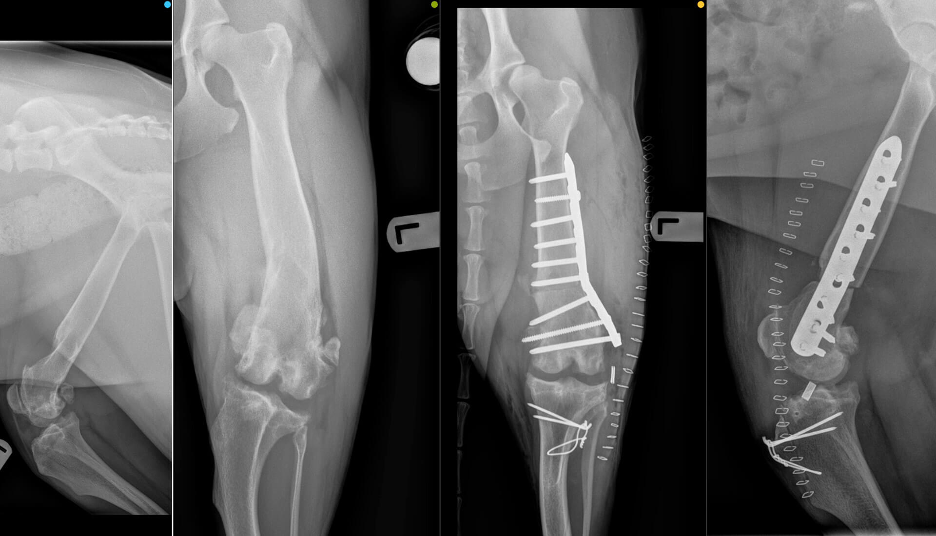 Xrays show the before and after of a surgery.