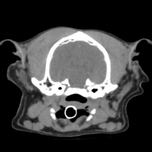 CT Scan