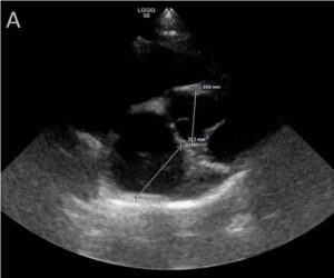 x-ray image of a canine aorta