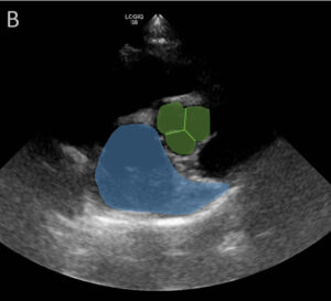 x-ray image of a canine aorta