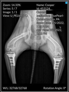 X-ray showing an ACL tear.