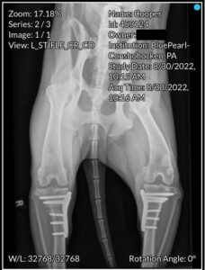 X-ray showing an ACL tear.