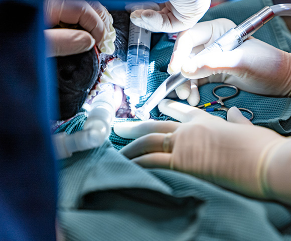 A closeup shot of Associates using tools to perform surgery in a patient's mouth.